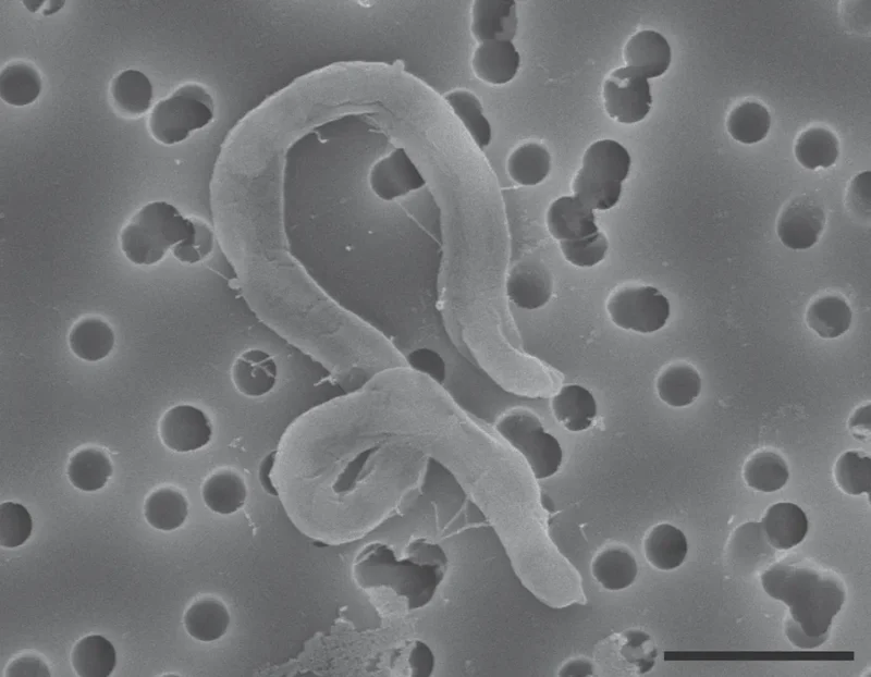 Gray microscope image shows a single spiral-shaped bacterium among round holes on a pitted surface.